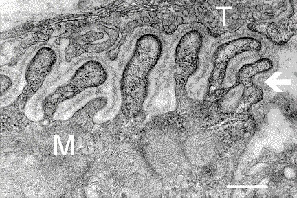 EM-Aufnahme eines synaptischen Spaltes